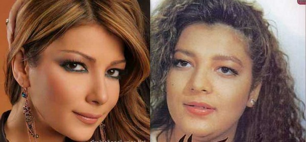 Arab Celebrities Before After